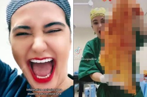 Plastik cərrahın ağlasığmaz əyləncəsi başına bəla oldu - VİDEO