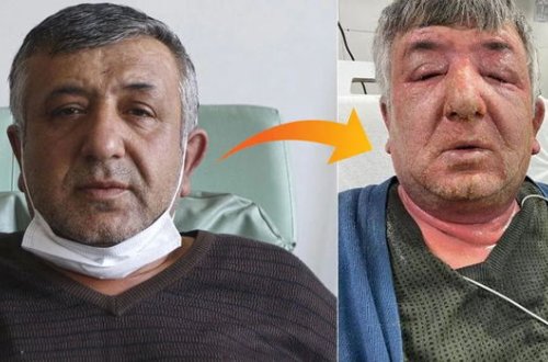 Şübhə taksi sürücüsünü xəstəxanalıq etdi - VİDEO