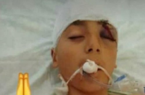 Ehtiyatsızlıqdan güllələnən uşağın FOTOLARI