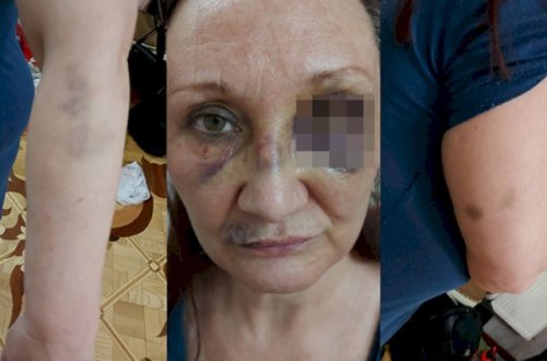 Bakıda futbolçunun qayınanası döyüldü - Fotolar