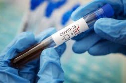 В каких регионах Азербайджана больше всего инфицированных СOVID-19? - ФОТО