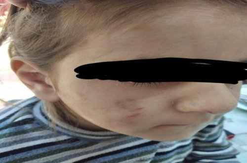 Azərbaycan ailəsində daha bir DƏHŞƏT: Atası döyür, anası isə...