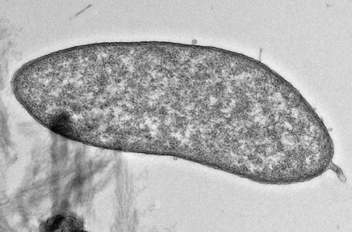 Xalis mis istehsal edən bakteriya tapılıb – FOTO