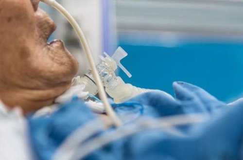 Azərbaycanda koronavirusdan ölənlərin sayı yenidən artdı - FOTO