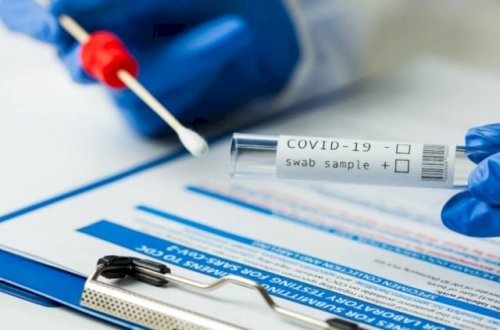 Virus dünyanı cənginə alıb: Yoluxanların sayı 154 milyonu ötdü