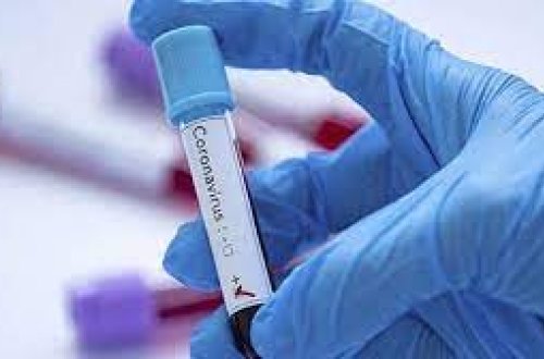 Yoluxanların sayı 1000-dən aşağı düşdü