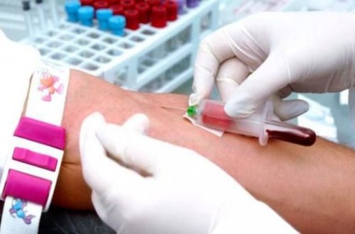 İcbari tibbi sığortaya daxil olan analizlər özəl xəstəxanalarda verilə bilərmi? - AÇIQLAMA