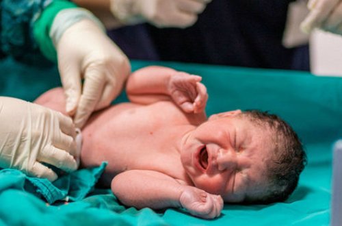 Ağciyərləri 100 faiz zədələnmiş qadın sağlam uşaq dünyaya gətirdi - FOTO