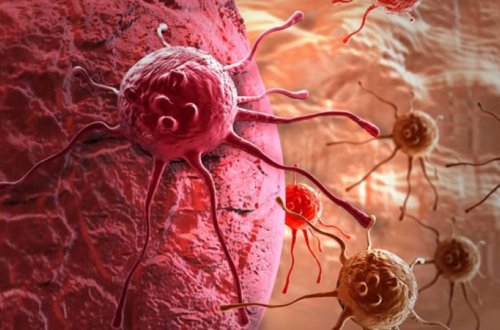 Xərçəngin yayılmasının qarşısını alan maddə tapıldı