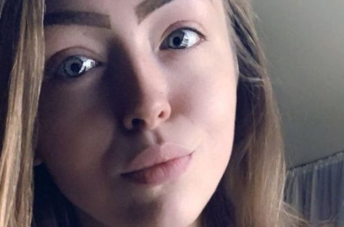 Девушка подхватила смертоносную инфекцию на вечеринке и лишилась ноги