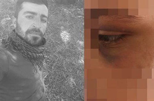 Türkiyədə qandonduran hadisə: Qadını zəncirləyib altı ay işgəncə verdi - FOTO