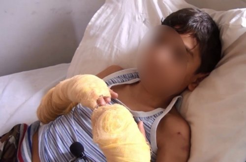 Bərdədə övladının əllərini yandıran qadın barəsində cinayət işi başlanıb