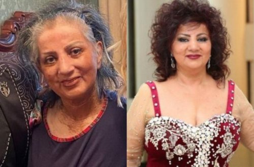 Zöhrə Abdullayevanın səhhəti ilə bağlı açıqalama - FOTO
