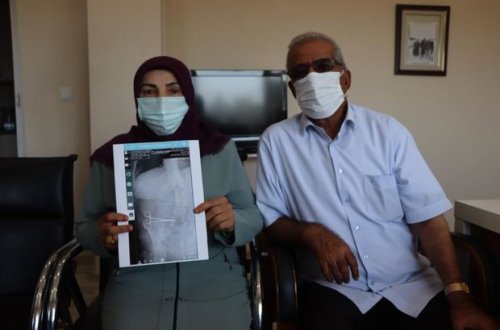 İki ay qarnındakı qayçı ilə yaşadı - FOTO