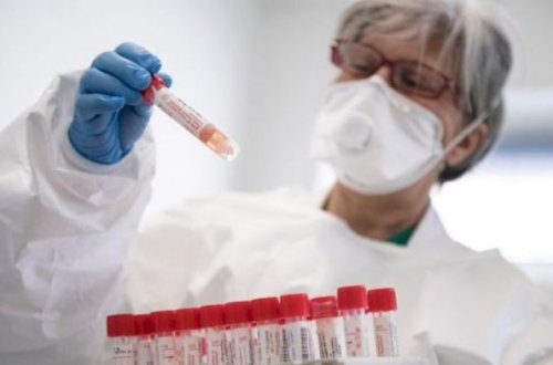 Gürcüstanda COVİD-19: 1 056 yeni yoluxma, 28 ölüm