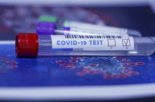 Ermənistanda COVİD-19: Ölənlərin sayı 4 428-ə yüksəldi