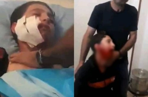 Azərbaycanda dəhşət: Canavar sürüsü şagirdlərə hücum etdi - VİDEO