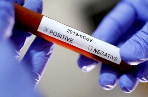 Ermənistanda daha 7 nəfər öldü