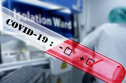 Analizi neqativ çıxan, lakin koronavirus olan şəxslər immunitet sertifikatı ala bilər? - RƏSMİ AÇIQLAMA