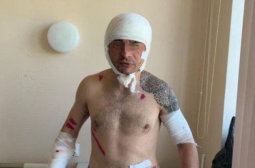 Özünü ölülüyə vurmaqla ayının pəncəsindən xilas oldu - FOTO