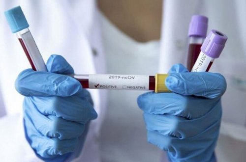 Azərbaycanda bir gündə dörd nəfər koronavirusdan öldü - FOTO