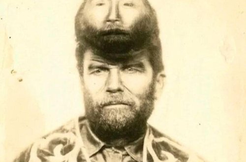 İkibaşlı adamın maraqlı həyatı - Alnındakı əlavə üzü ilə qürur duyurdu