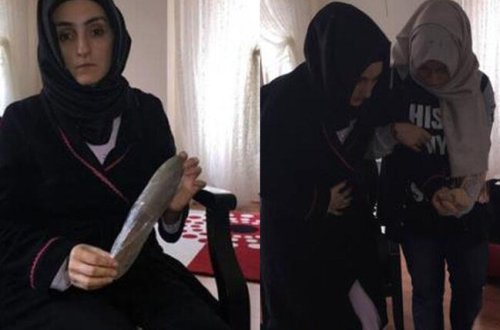 Cərrah malanı xəstənin qarnında unutdu - Qalmaqal - FOTO