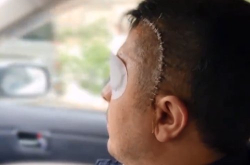 Düşmənin iki tankını, bir məntəqəsini məhv etdim - Gözünü itirən qazimiz - FOTO