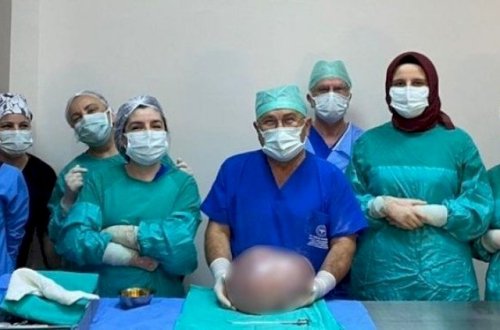 İnanılmaz: Hamilə olduğu güman edilən qadının qarnından görün nə çıxdı