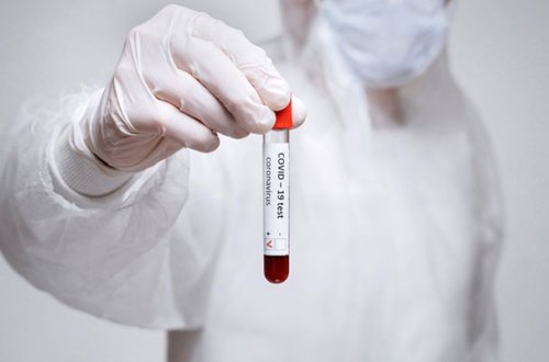 Türkiyədə koronavirusdan ölənlərin sayı azaldı