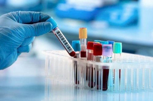 Bakıda koronavirusa ən çox və ən az yoluxma bu ərazilərdədir