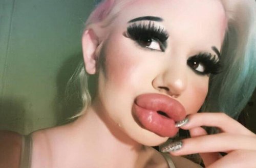 Görənləri qorxutsa da, görünüşündən razıdır - Ən böyük dodağ sahibi - FOTO