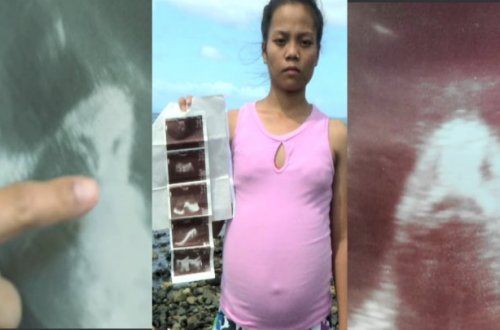 17 yaşlı qız balıqdan hamilə qaldı? - DƏHŞƏTLİ VİDEO