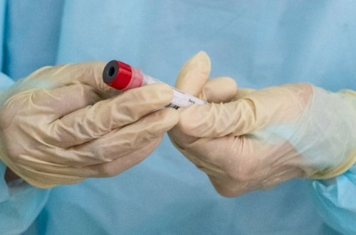 Qonşu ölkədə koronavirus tüğyan edir - Statistika