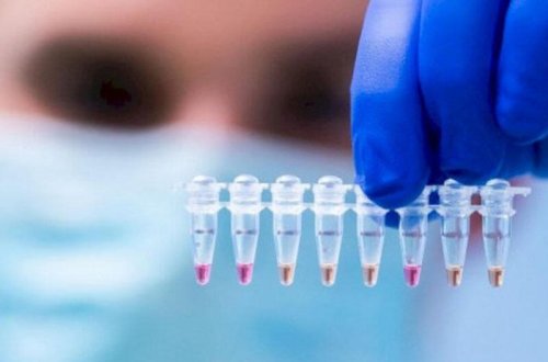 Baş infeksionistdən koronavirusa yoluxma hallarında artımla bağlı XƏBƏRDARLIQ - VİDEO