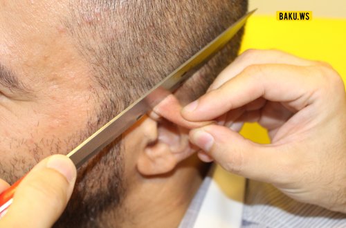 Azərbaycanda 37 yaşlı kişinin qulağını kəsdilər