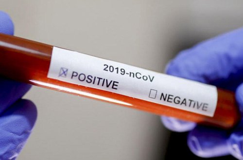 Türkiyənin 3 vilayətində “Delta plus” ştammına yoluxma qeydə alındı