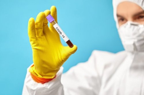 Rusiyada bir gündə 734 nəfər koronavirusdan ölüb