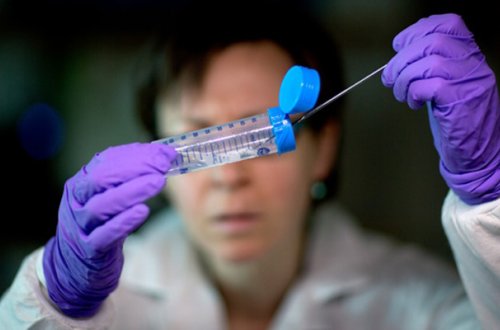 Azərbaycanda son sutkada koronavirusdan iki nəfər ölüb - FOTO