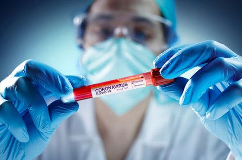 Türkiyədə yoluxanların sayı artdı