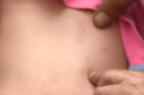 Bakıda bağçada uşağa qarşı zorakılıq - 2 yaşlı uşağı bu hala kim saldı? - VİDEO