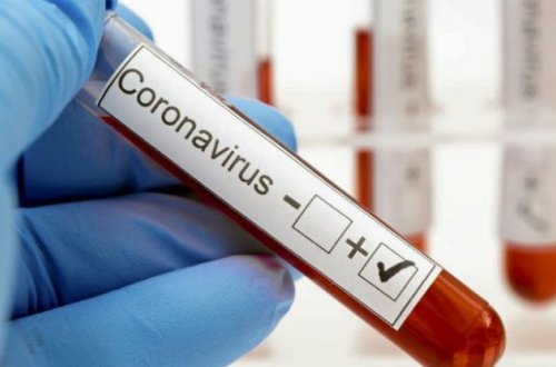 Azərbaycanda koronavirusun 