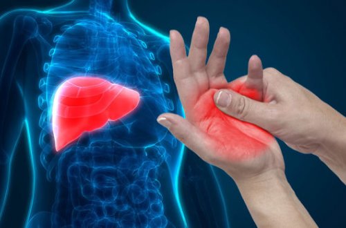 На жировую болезнь печени укажут четыре признака на руках