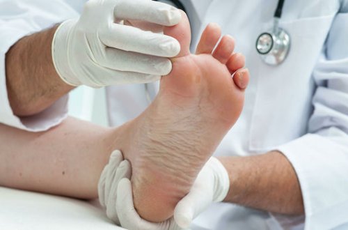 Назван признак опасного уровня холестерина, заметный на ногах