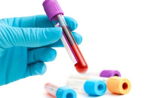 Иммунолог посоветовала сделать анализ крови перед прививкой против COVID-19