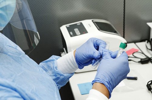 Azərbaycanda son sutkada koronavirusa 386 yeni yoluxma faktı qeydə alınıb - FOTO