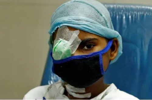 Koronavirusdan sağalanların kabusu: Bu xəstəliyə tutulanların yarısı ölür