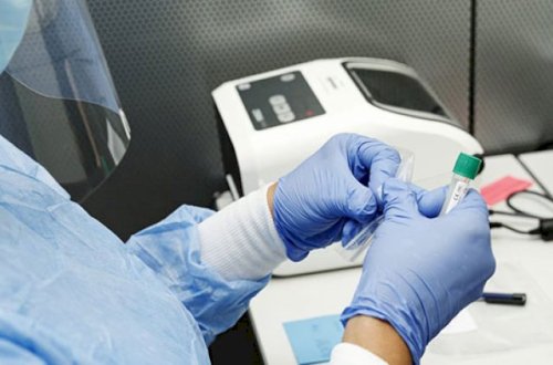 Gürcüstanda virus DƏHŞƏT SAÇIR: Son sutkada 20 nəfər öldü