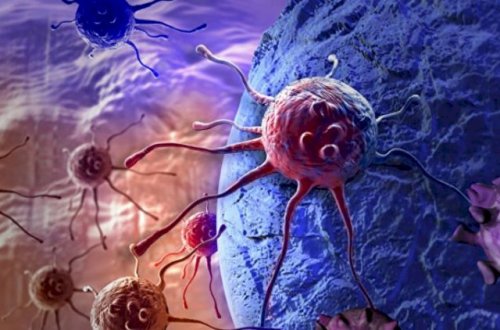 3 növ xərçəngin çarəsi tapılır - ÜST-dən şad xəbər