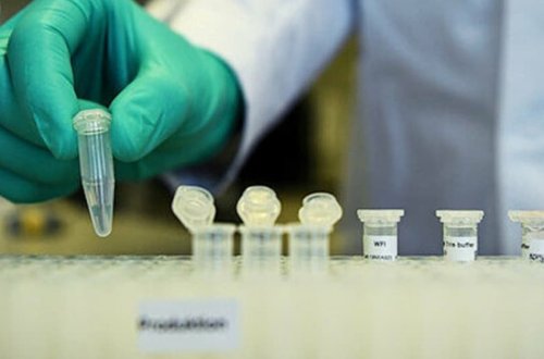 Ermənistanda son sutka ərzində koronavirusa 229 nəfər yoluxub